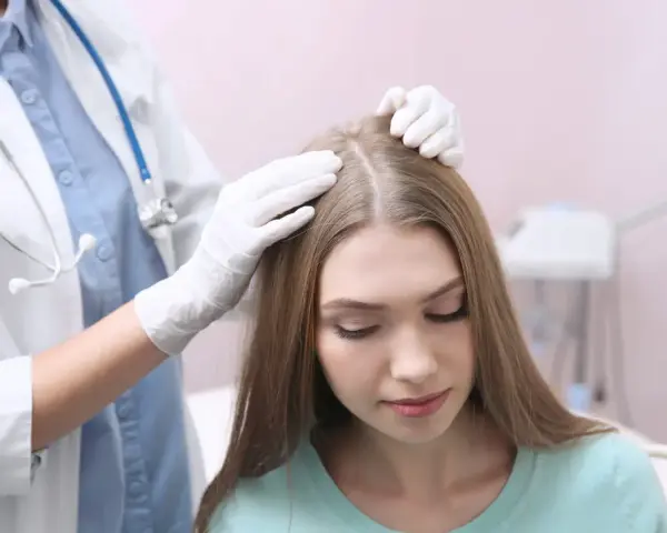 Lekarz w białej rękawiczce bada skórę głowy pacjentki, która skarży się na swędzenie.