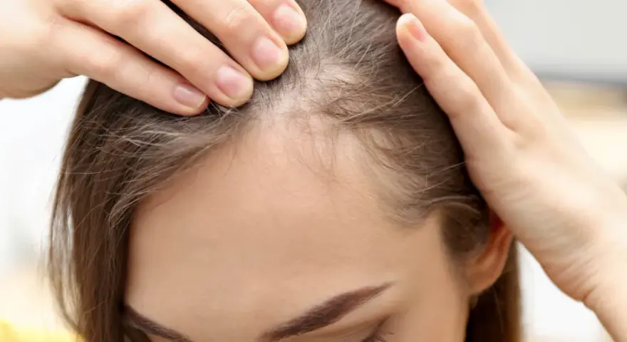 Dłonie kobiety dotykają jej głowy, sprawdzając przerzedzone włosy. Widać delikatne, cienkie włoski, przypominające baby hair, które mogą świadczyć o problemach z wypadaniem włosów.